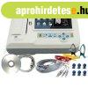 Hordozhat� EKG k�sz�l�k CMS 600G 6 csatorn�s