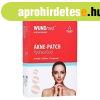 WundMed Akne tapasz 24 db