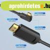 Vention USB-C -> HDMI, 1,5m, (jobbos, fekete), k�bel