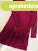 Chipi&Chips nagyl�ny csipke ruha/s�t�t pink