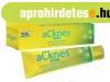 ESI aCknes gl - Akns brre, mint pattans, mitesszer, fe