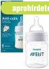 Philips AVENT Hasfjscskkent cumisveg SCY100/01 125 ml 0