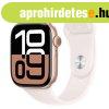 Apple Watch Series 10 GPS + Cellular 46mm Rzsaszn-arany al