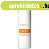 Sun napozs utni testpol spray - doTERRA